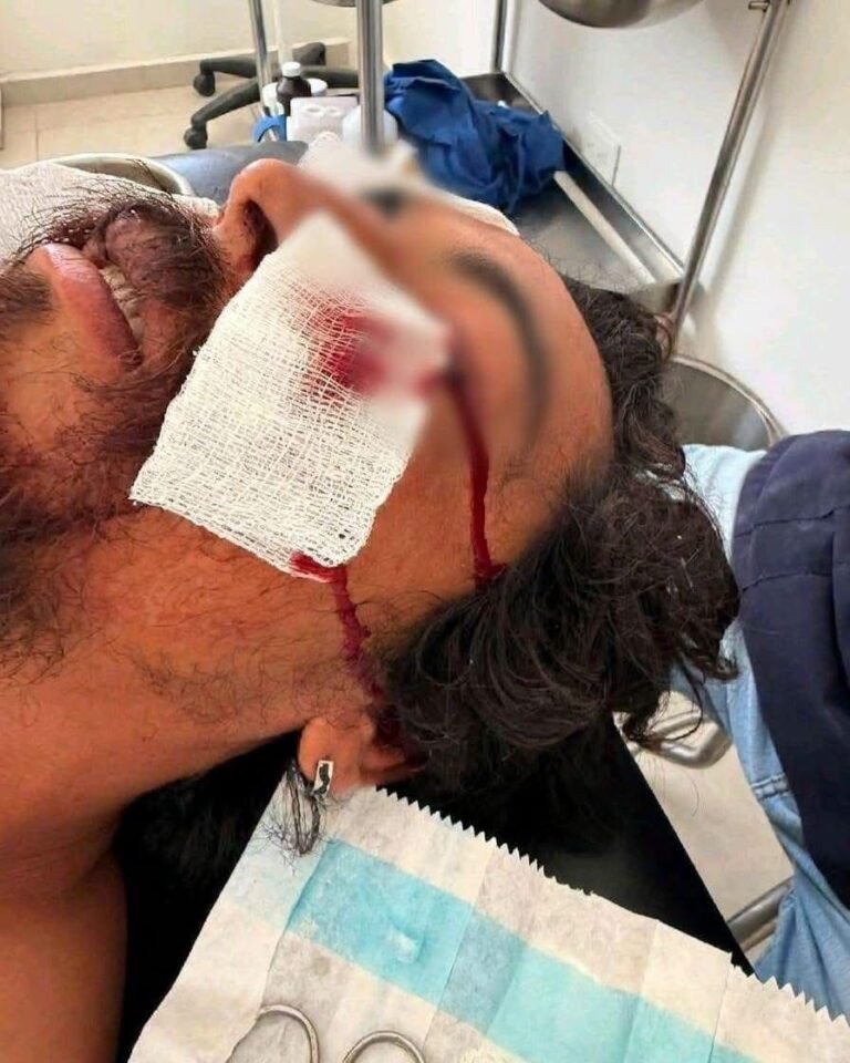 Investigan incidente en Sisal que dejó a pescador hospitalizado; señalan presunta participación de funcionario municipal